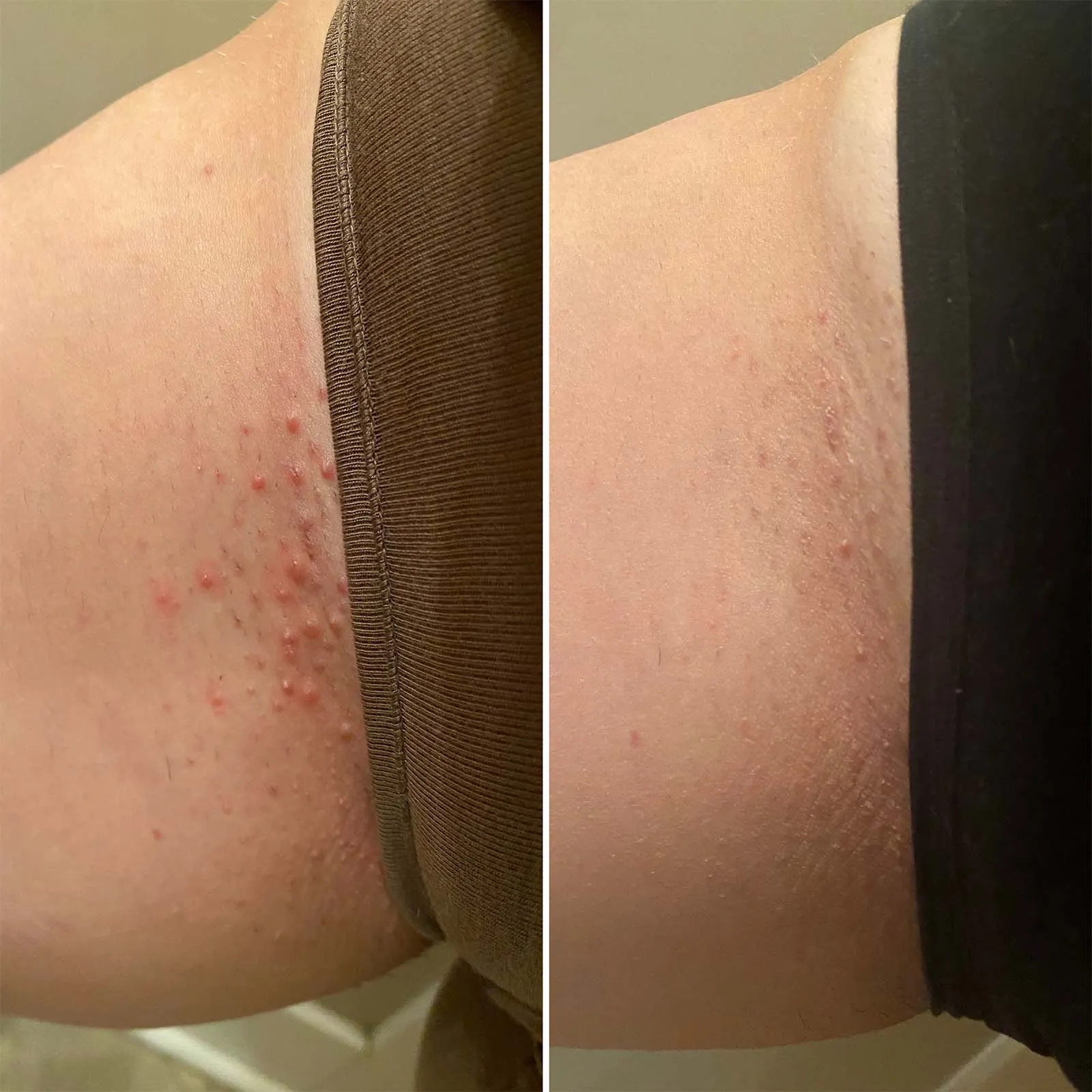 BushBalm: Nude Ingrown Hair Scrub