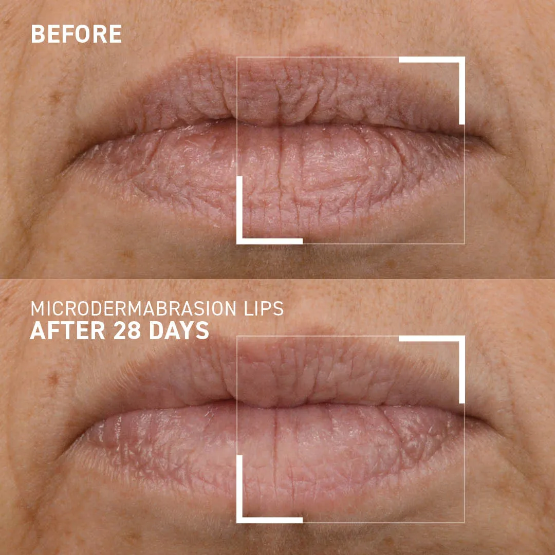 SMOOTHING LIP EXFOLIATOR